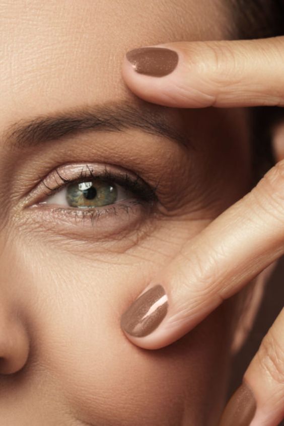 Blepharoplasty