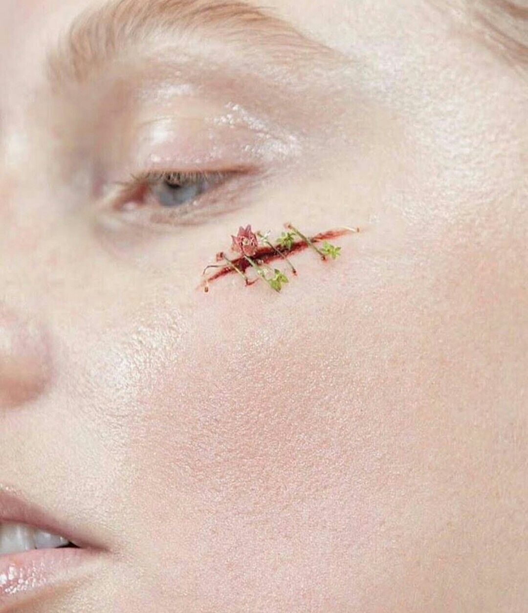 Scar revision